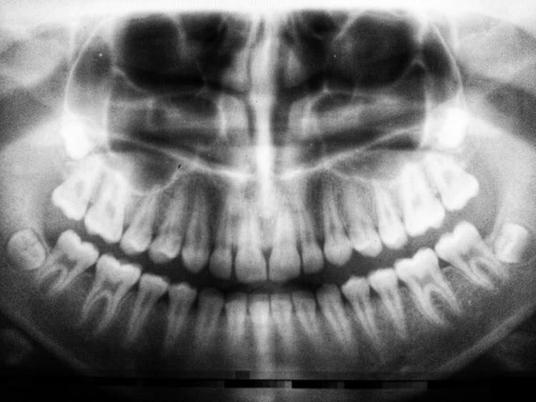 狗狗磨牙棒,狗狗磨牙棒多少钱一根正常插图